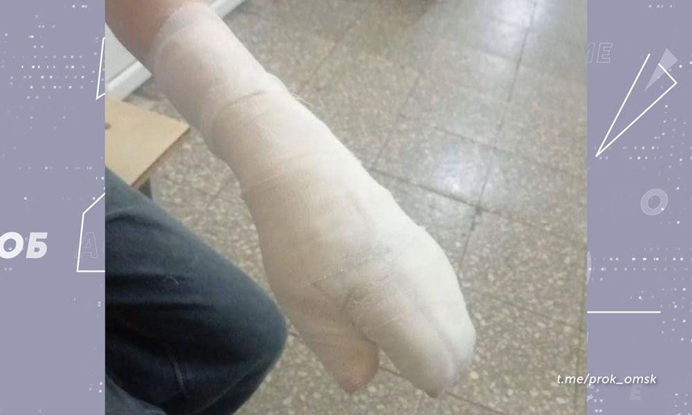 В омском суде обязали владельца собаки, укусившей ребёнка, выплатить 300 тысяч рублей в качестве компенсации морального вреда 