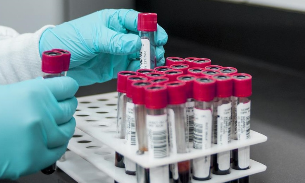 Донорство костного мозга: шанс спасти чью-то жизнь или риск для здоровья?