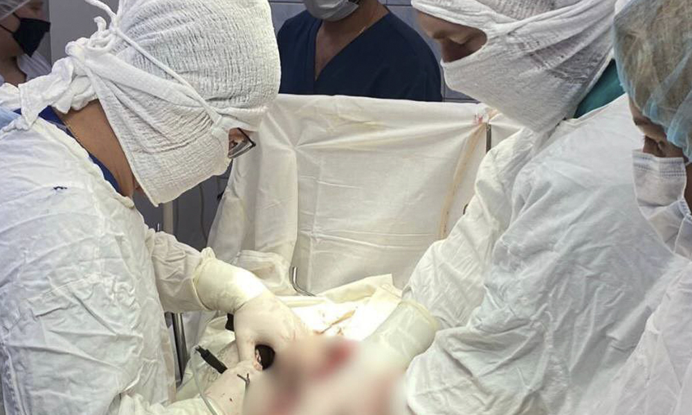 Омские медики спасли пациента с тяжёлым хирургическим заболеванием