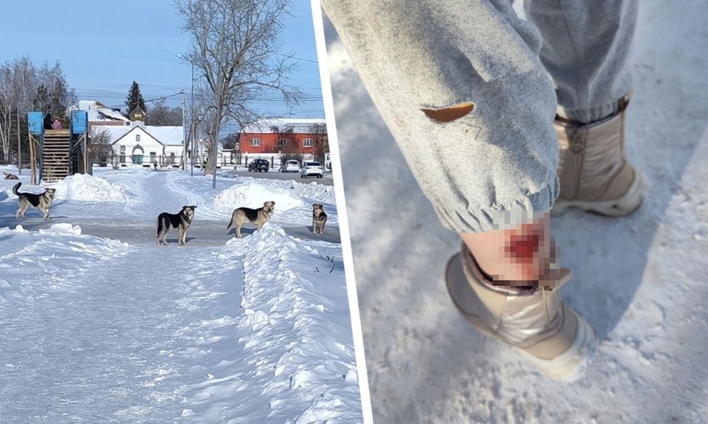 Омских следователей заинтересовала история с нападением бродячих собак на человека в посёлке Лузино 