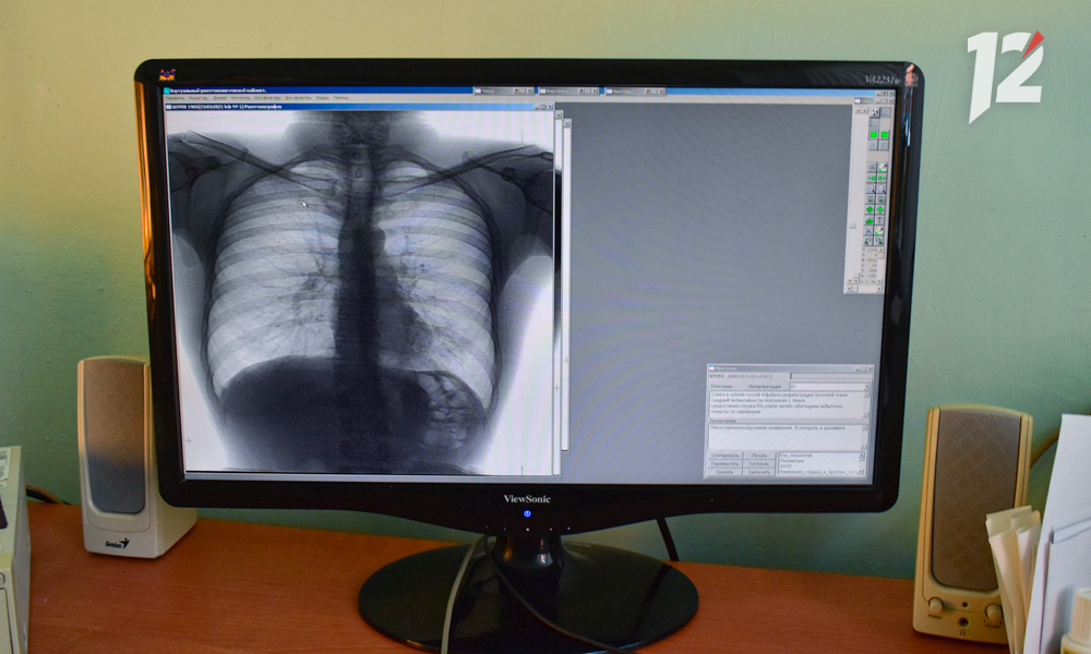 Омскстат проанализировал снижение числа инфекционных заболеваний на территории региона