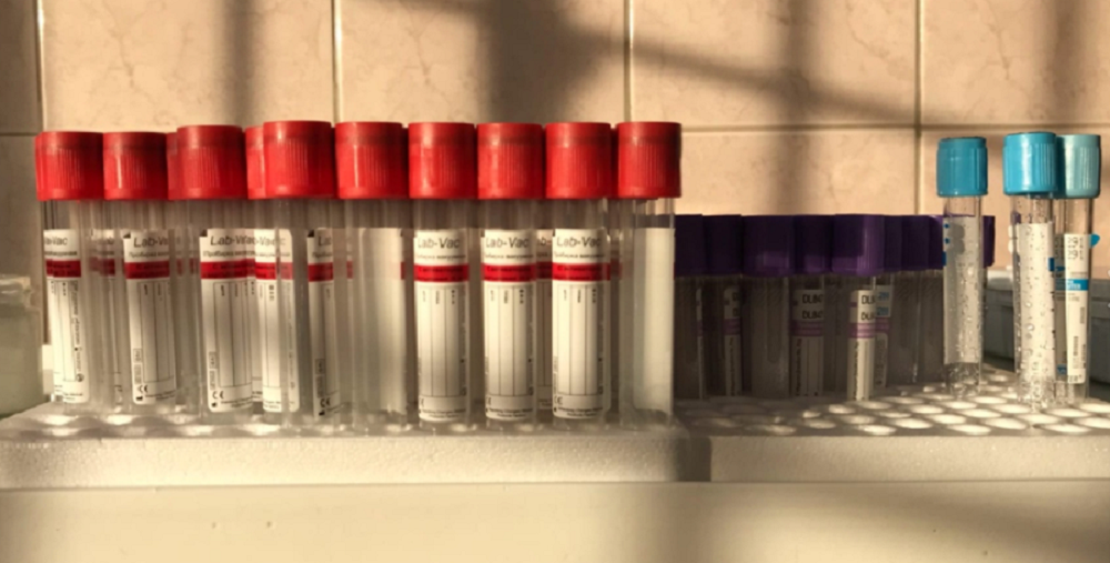 В омской деревне отменили карантин, который был введён из-за инфекционной анемии у лошадей 