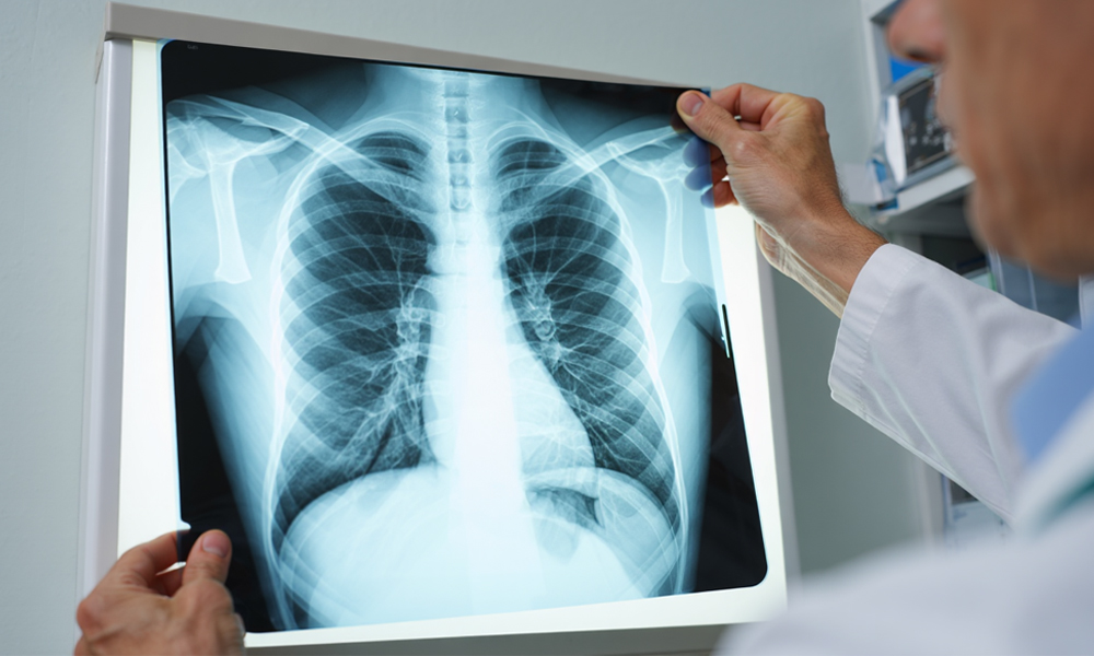 Омичам объяснили различия между КТ, МРТ и рентгеном