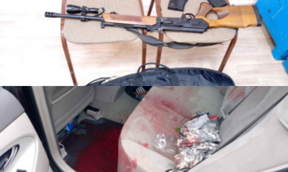 Из-за случайного выстрела омичу ампутировали ногу