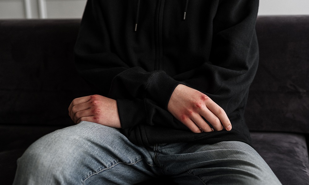 16-летний омич избил битой двух взрослых мужчин из-за выпаса коров