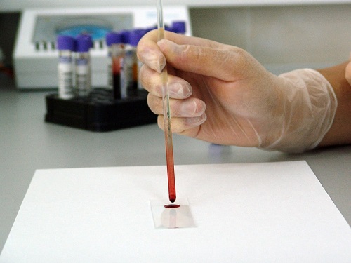 Омичи смогут бесплатно и анонимно узнать свой ВИЧ-статус в передвижной лаборатории СПИД-центра