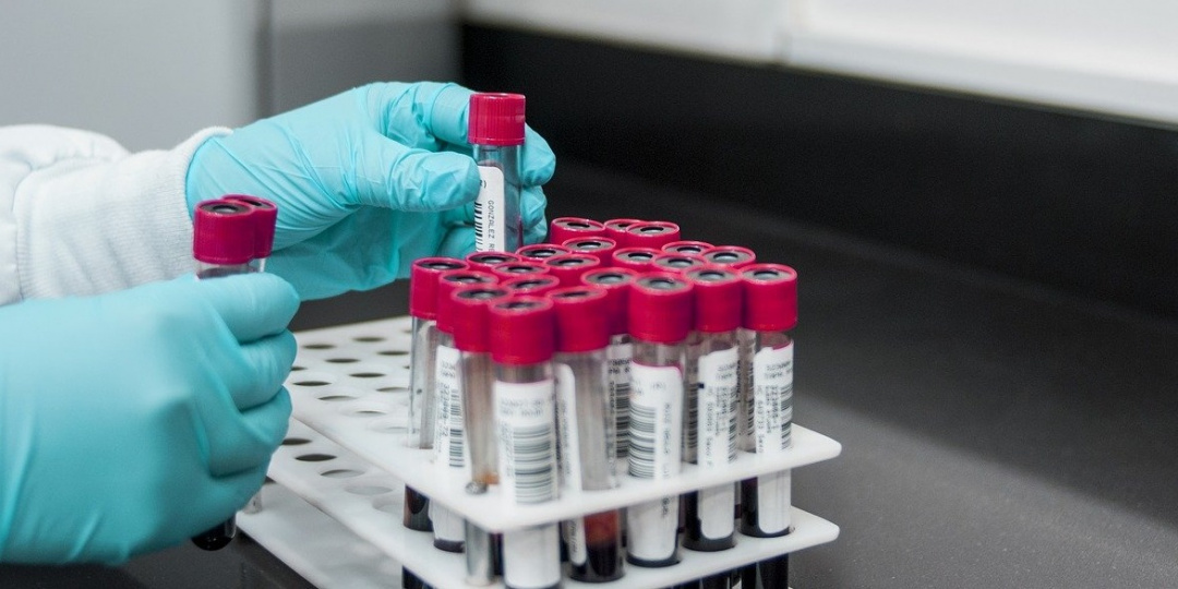 Коронавирус перемещается из городов в сёла и деревни