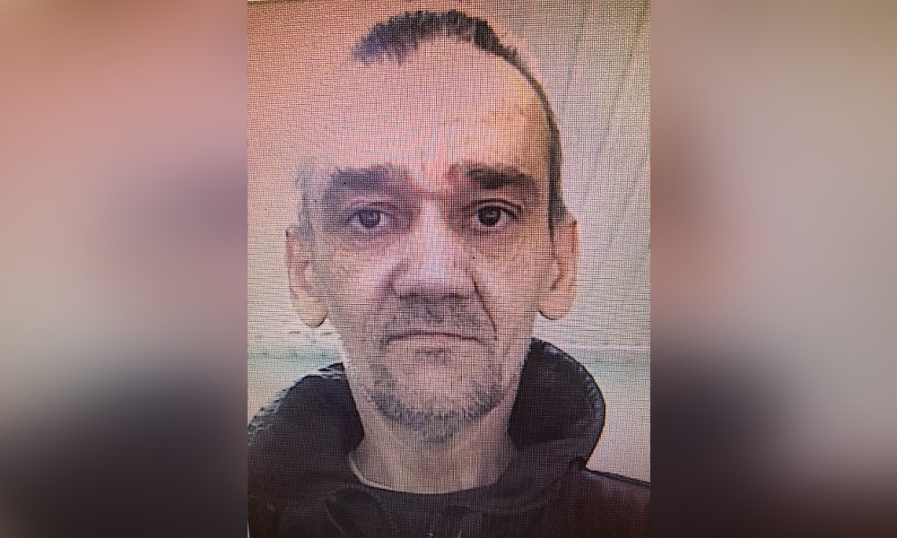 Ожоги на обеих руках: разыскивают омича, который несколько месяцев назад ушёл из центра социальной адаптации 