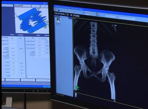 Диагностировавшим рак врачам выплатят премию