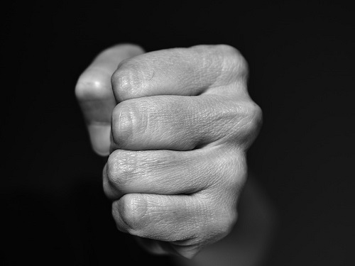 Омскому танцору ревнивый жених партнёрши сломал челюсть