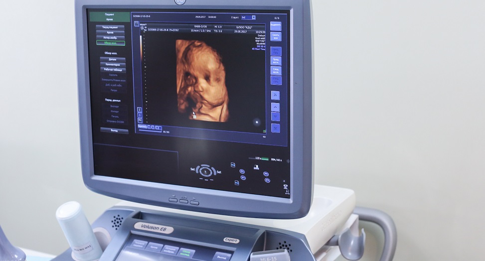 В Омске будущие мамы могут рассмотреть своего малыша ещё до его рождения