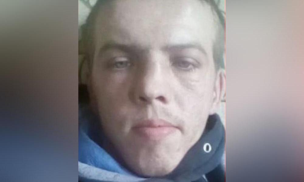 В Омске ищут 31-летнего мужчину со шрамом под левым глазом