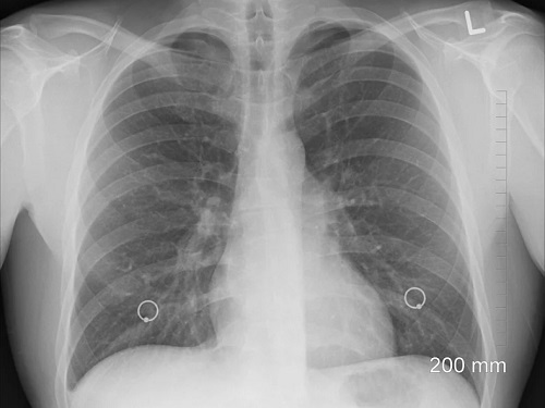 Бездомному пастуху в Омской области сломали ребро
