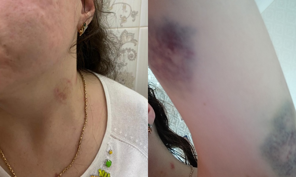 Умоляла пощадить ради детей: омич жестоко избил бывшую супругу на глазах у маленькой дочки