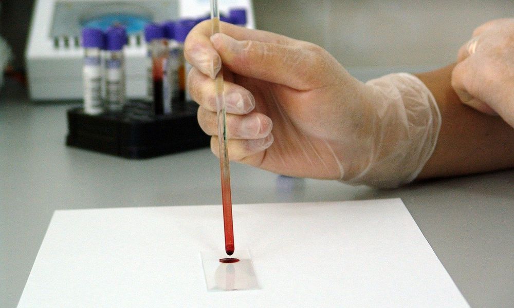 Больше всего ВИЧ-инфицированных проживает в Ленинском округе Омска