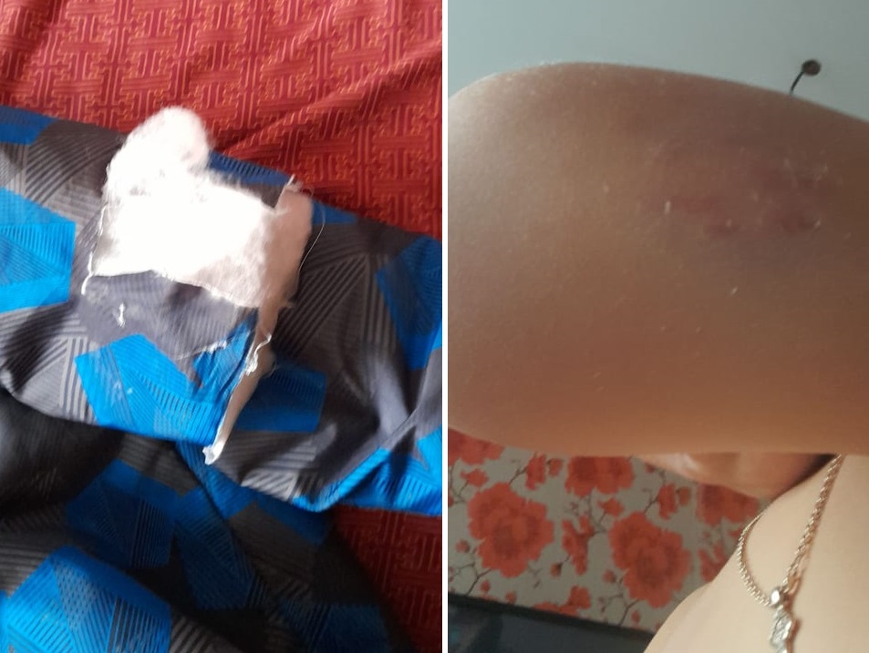 Разодрала куртку и укусила: в Омске на школьника напала бродячая собака