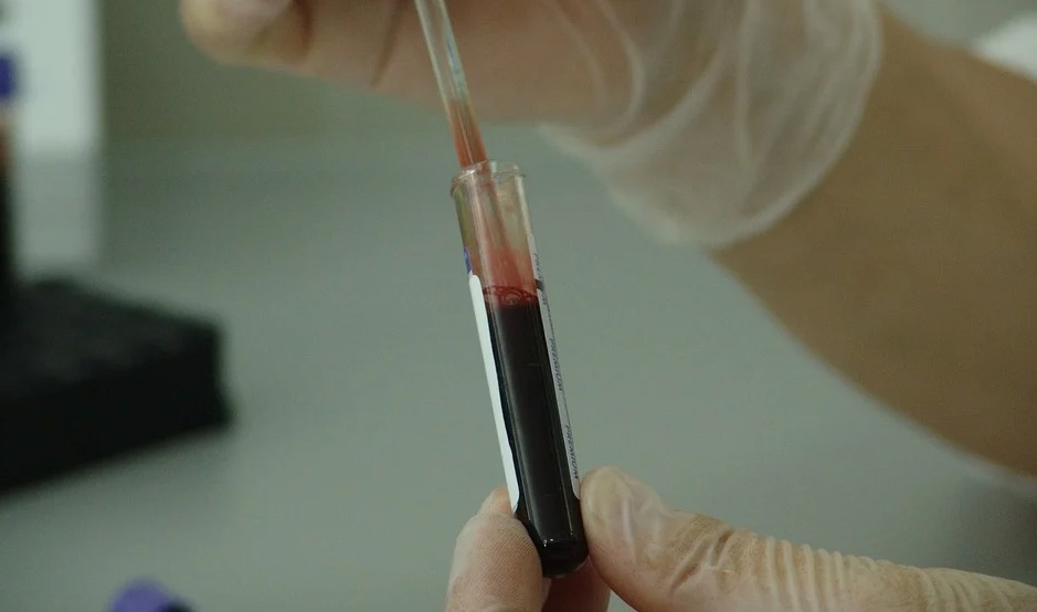 Омичей приглашают сдать бесплатный тест на ВИЧ