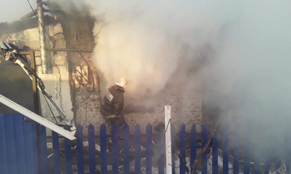 Жительница Калачинска , получившая 90% ожогов тела, скончалась в больнице 