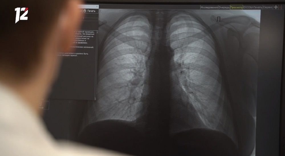 В Омской области заболеваемость туберкулёзом снизилась в три раза