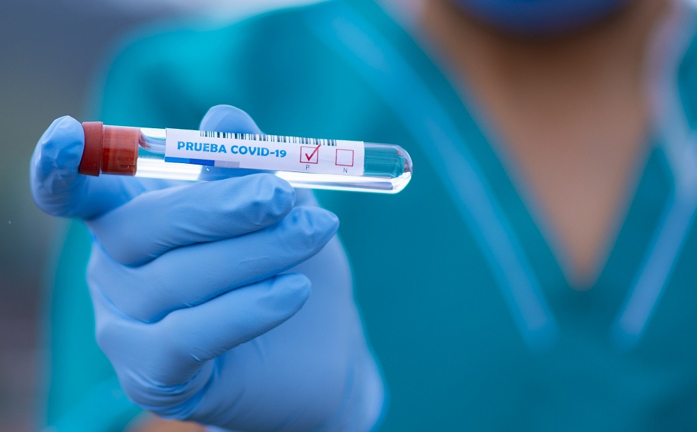 Ещё один омский медцентр начал делать тесты на антитела к коронавирусу